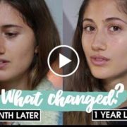 No Makeup Challenge  1 YEAR LATER