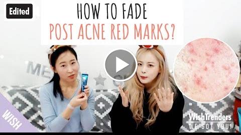 [Edited] How to Fade Post Acne Red Marks? Post Acne Skin Care Tips  My Acne Story  WWGY