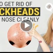 All You Have to Know for Perfect Blackhead Removal (Feat.Special Guest)  Wishtrend TV